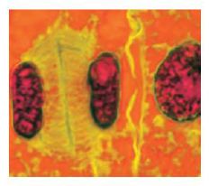 انويم نباتي